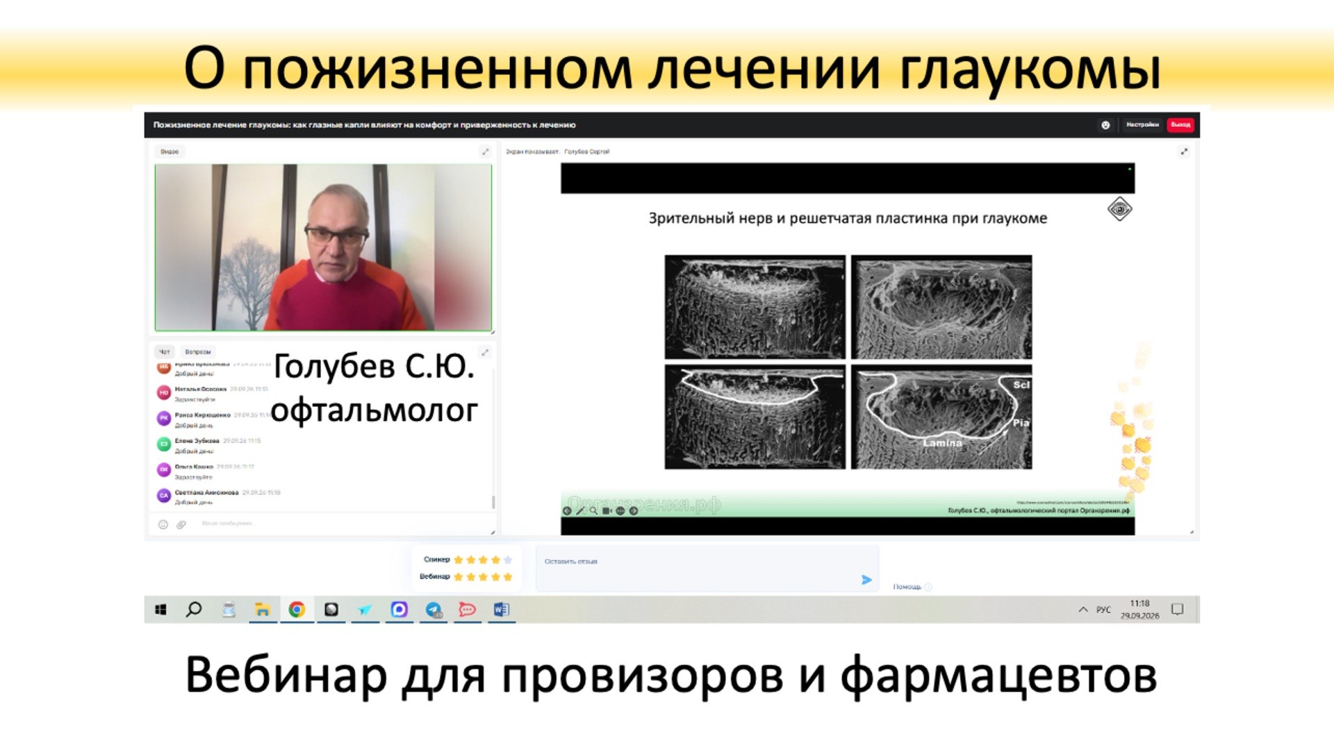 Глаукома Вебинар для провизоров и фармацевтов