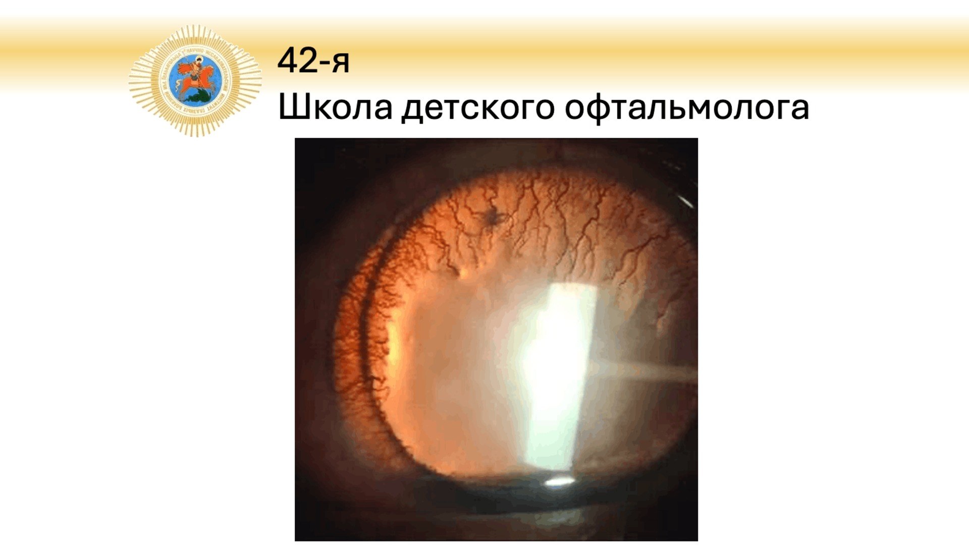 Школа детского офтальмолога 42