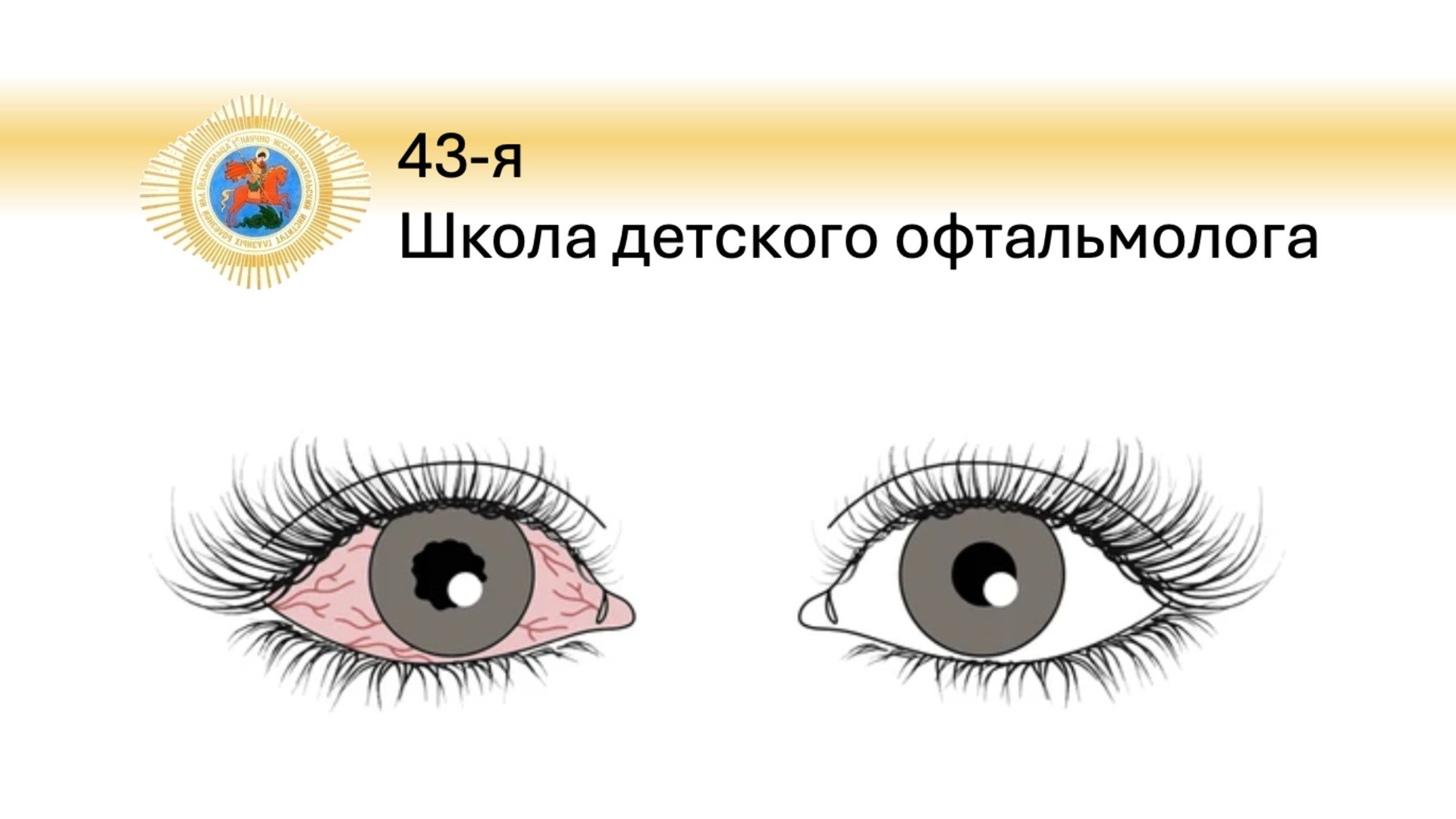 Школа детского офтальмолога 43